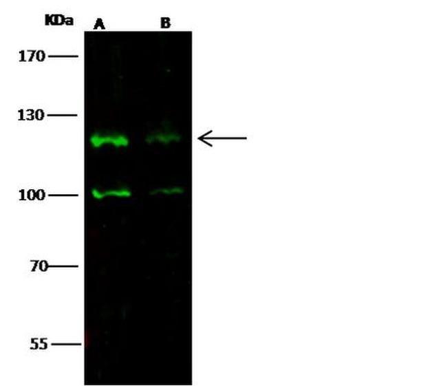 CD163 Antibody in Western Blot (WB)
