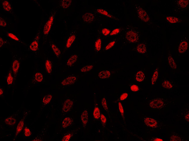 GSC Antibody in Immunocytochemistry (ICC/IF)
