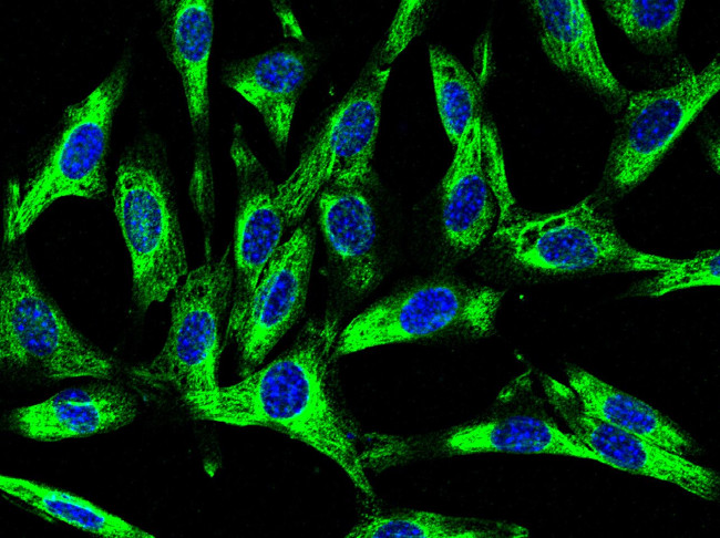 CD106 (VCAM-1) Antibody in Immunocytochemistry (ICC/IF)