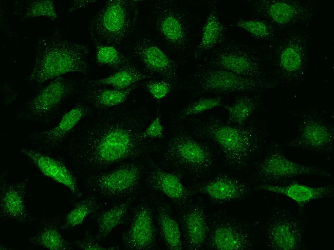 E2F4 Antibody in Immunocytochemistry (ICC/IF)
