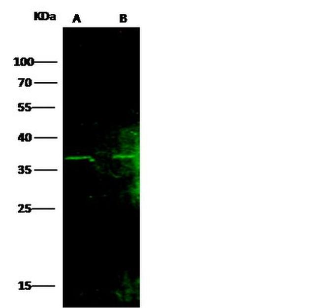 FBXO6 Antibody in Western Blot (WB)