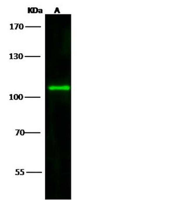 TLR8 Antibody in Western Blot (WB)