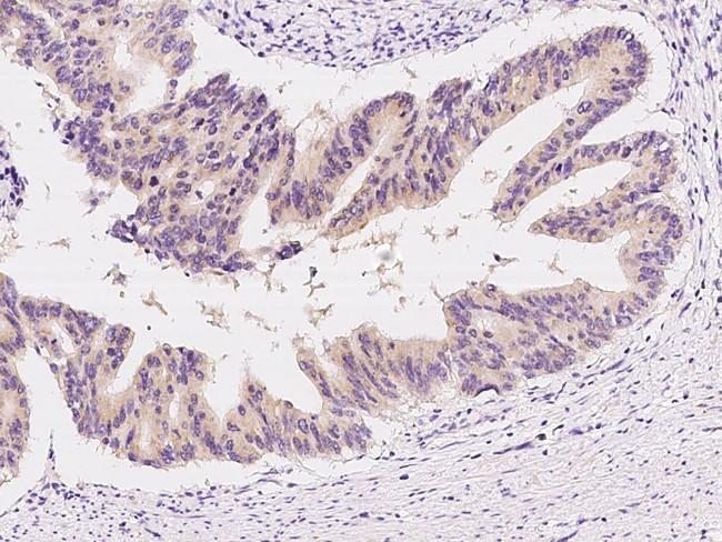 GH2 Antibody in Immunohistochemistry (Paraffin) (IHC (P))