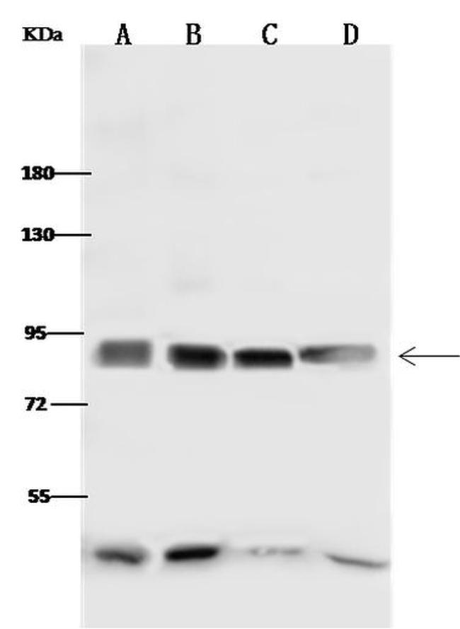 ALDH18A1 Antibody in Western Blot (WB)