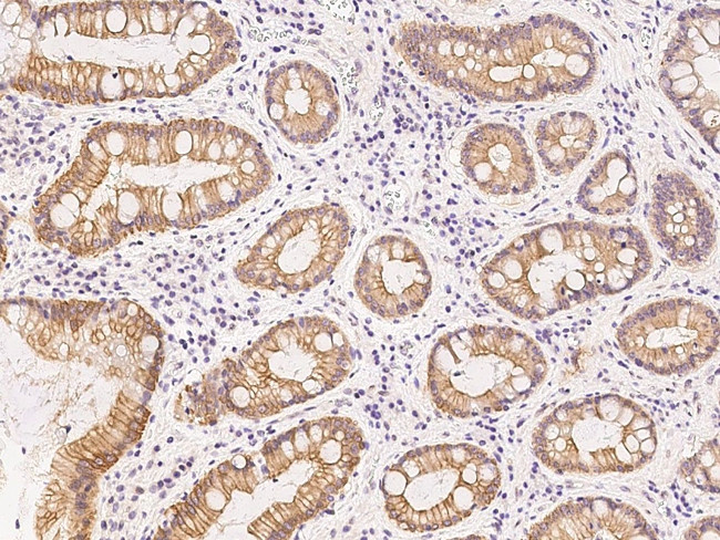 Nurim Antibody in Immunohistochemistry (Paraffin) (IHC (P))