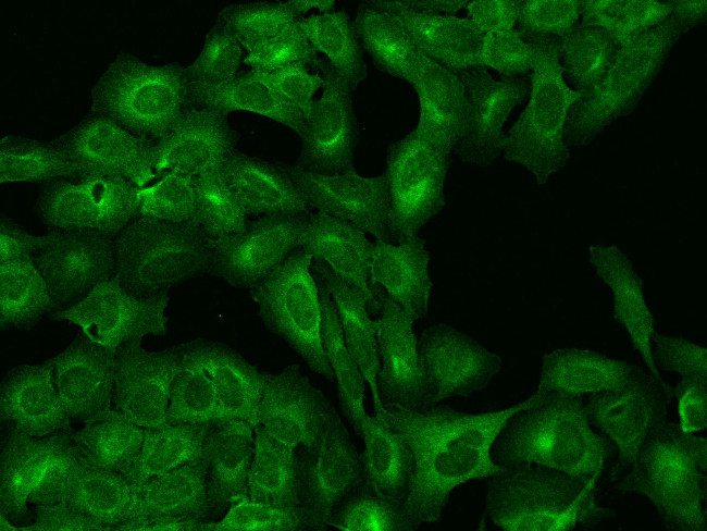 VTA1 Antibody in Immunocytochemistry (ICC/IF)