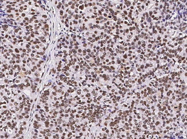 RbAp48 Antibody in Immunohistochemistry (Paraffin) (IHC (P))