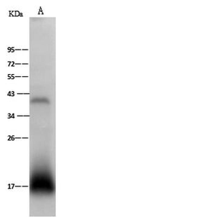 ARMET Antibody in Western Blot (WB)