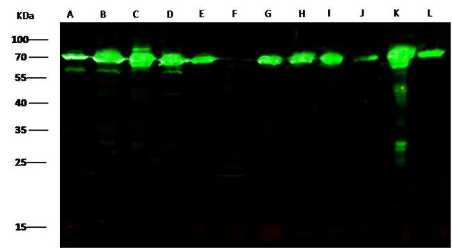 HSP70 Antibody in Western Blot (WB)