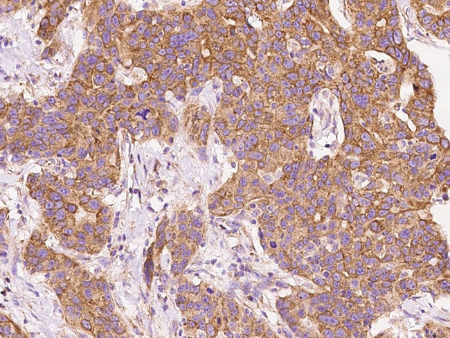 BNIP3L Antibody in Immunohistochemistry (Paraffin) (IHC (P))