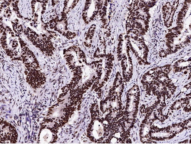 RPRD1B Antibody in Immunohistochemistry (Paraffin) (IHC (P))