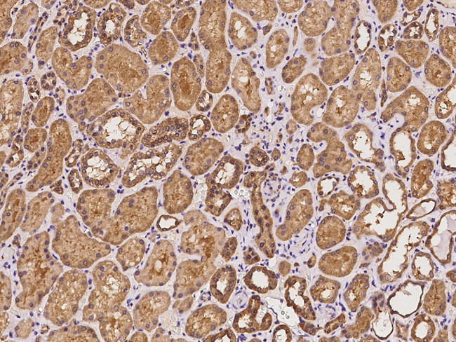 ARF3 Antibody in Immunohistochemistry (Paraffin) (IHC (P))