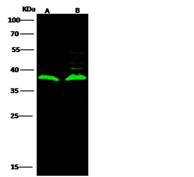 LRP15 Antibody in Western Blot (WB)