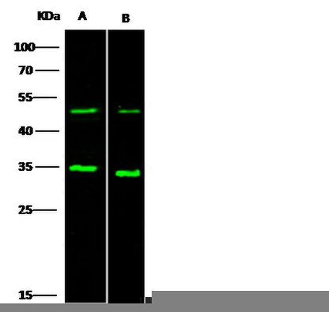 GMFG Antibody in Western Blot (WB)