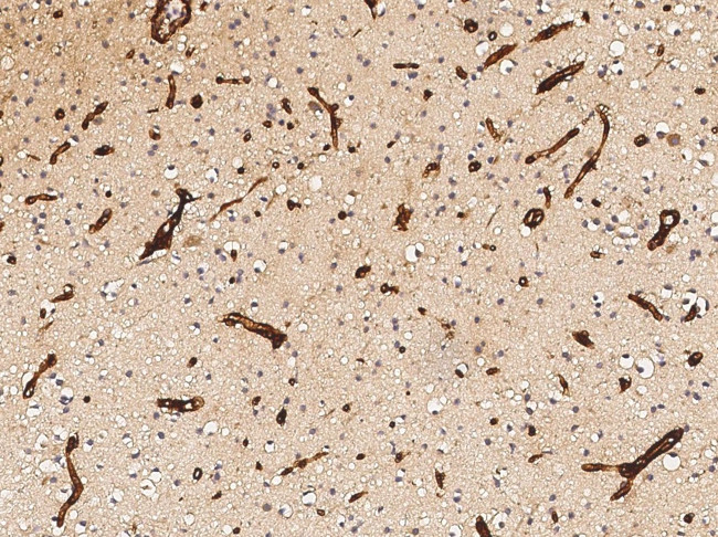 GGT5 Antibody in Immunohistochemistry (Paraffin) (IHC (P))