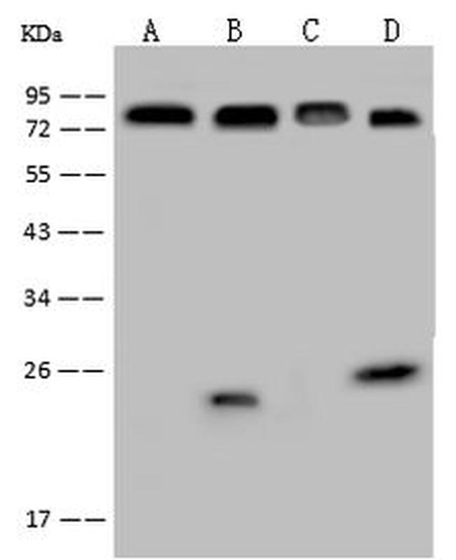 Prolactin Receptor (ECD) Antibody in Western Blot (WB)