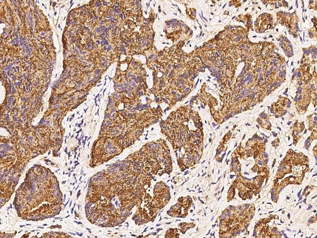 PRELID1 Antibody in Immunohistochemistry (Paraffin) (IHC (P))