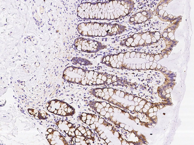 MUT Antibody in Immunohistochemistry (Paraffin) (IHC (P))