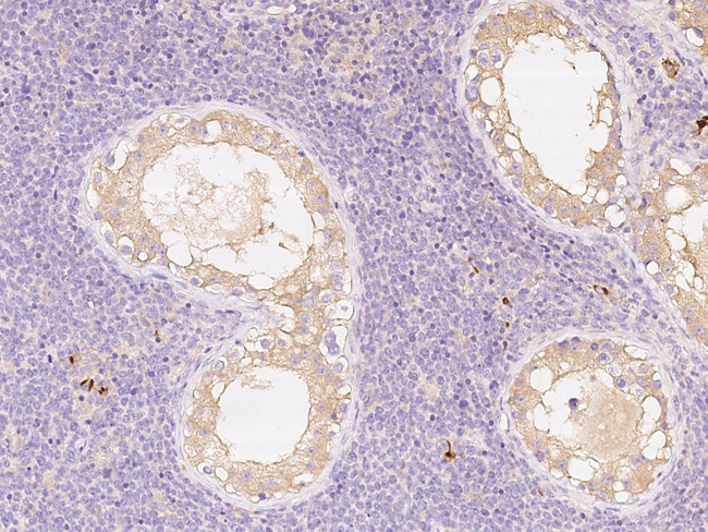 EB1 Antibody in Immunohistochemistry (Paraffin) (IHC (P))