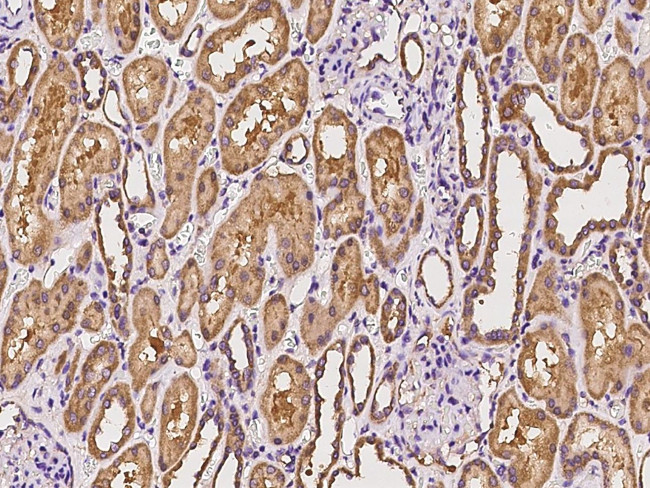 MRPL19 Antibody in Immunohistochemistry (Paraffin) (IHC (P))