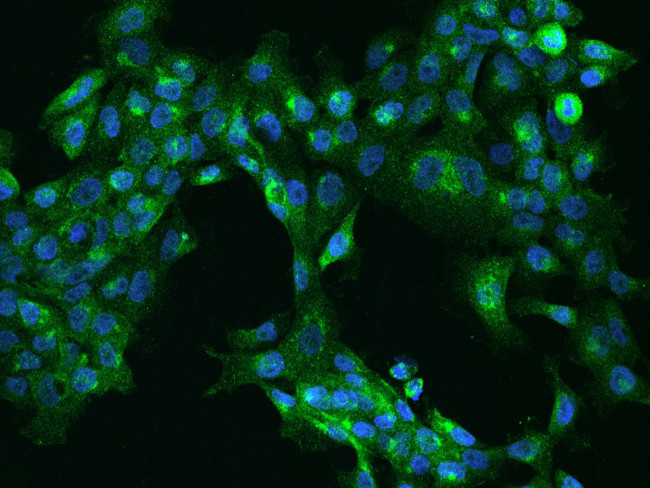 SCAMP4 Antibody in Immunocytochemistry (ICC/IF)