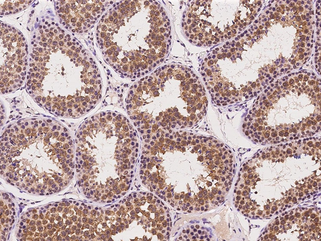 IFT81 Antibody in Immunohistochemistry (Paraffin) (IHC (P))