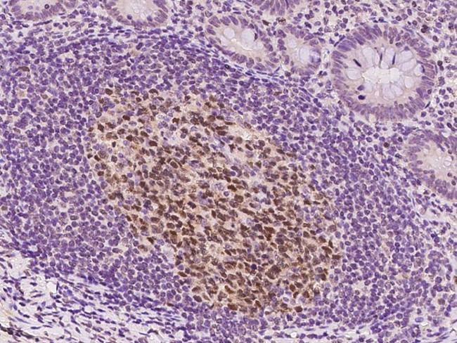 EAF2 Antibody in Immunohistochemistry (Paraffin) (IHC (P))