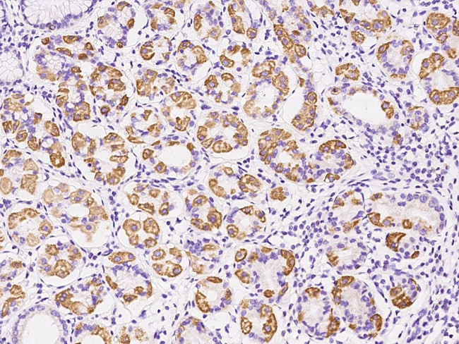 MTCO2 Antibody in Immunohistochemistry (Paraffin) (IHC (P))
