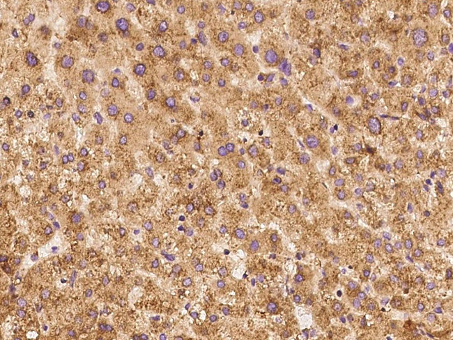 RPS18 Antibody in Immunohistochemistry (Paraffin) (IHC (P))