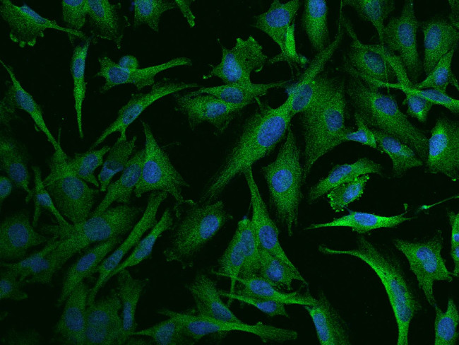 RPL9 Antibody in Immunocytochemistry (ICC/IF)