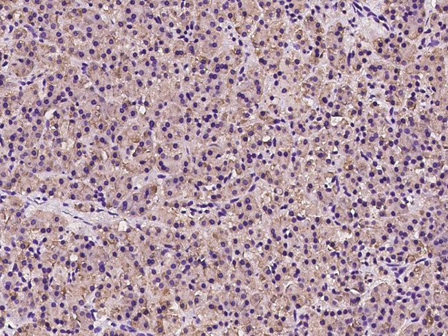 RPS17 Antibody in Immunohistochemistry (Paraffin) (IHC (P))