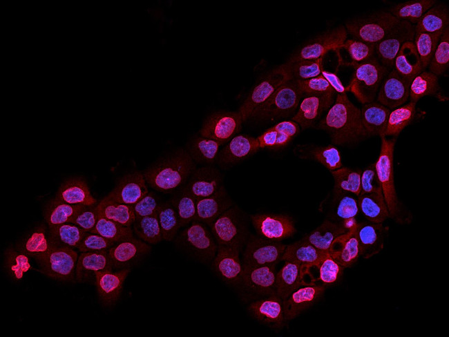 LAP2 Antibody in Immunocytochemistry (ICC/IF)