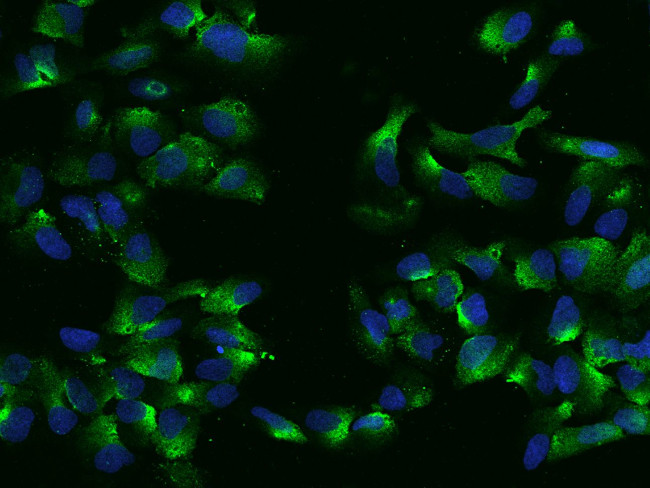 Ubiquilin 2 Antibody in Immunocytochemistry (ICC/IF)