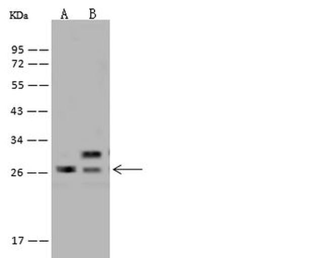SPC24 Antibody in Western Blot (WB)