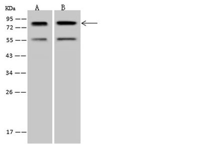 PCIF1 Antibody in Western Blot (WB)
