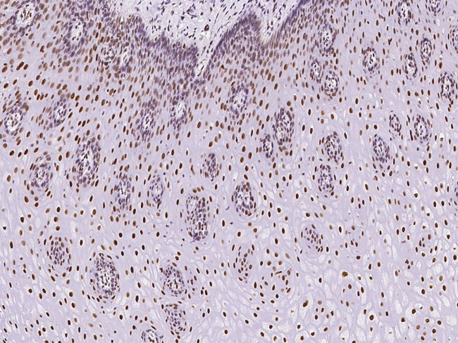 PCYT1A Antibody in Immunohistochemistry (Paraffin) (IHC (P))