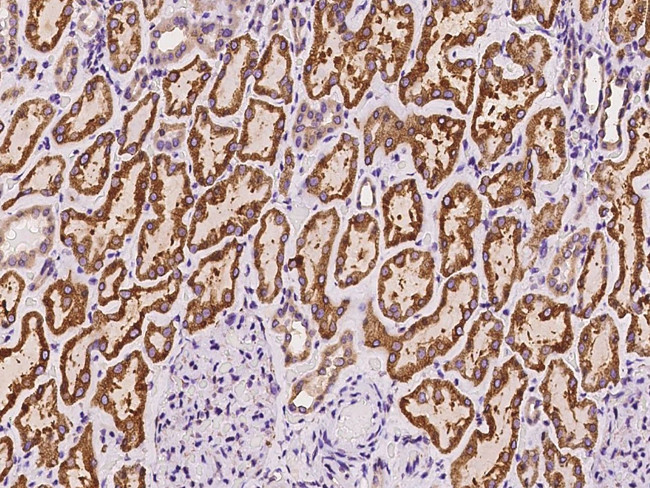 PGRMC1 Antibody in Immunohistochemistry (Paraffin) (IHC (P))