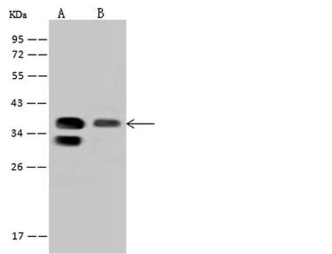 PPP1R3C Antibody in Western Blot (WB)