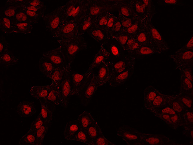 ADNP Antibody in Immunocytochemistry (ICC/IF)