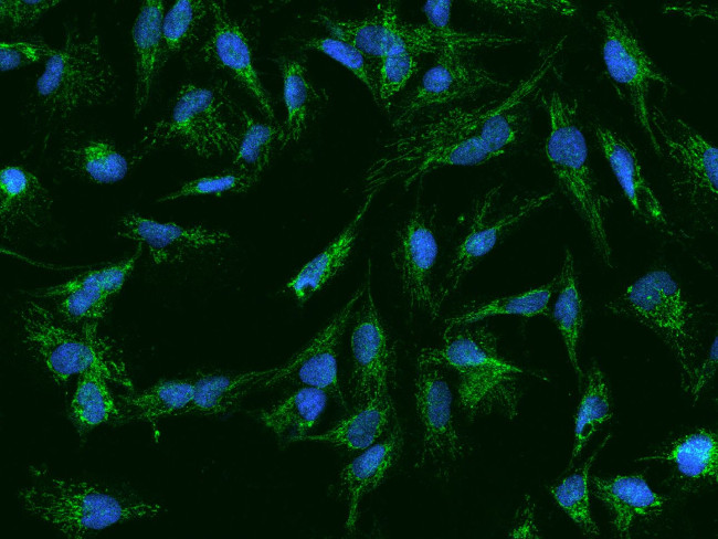 AFG3L2 Antibody in Immunocytochemistry (ICC/IF)