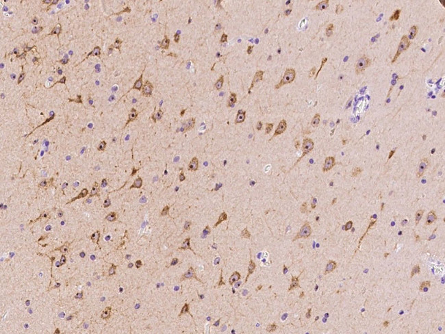 MAP1 Antibody in Immunohistochemistry (Paraffin) (IHC (P))