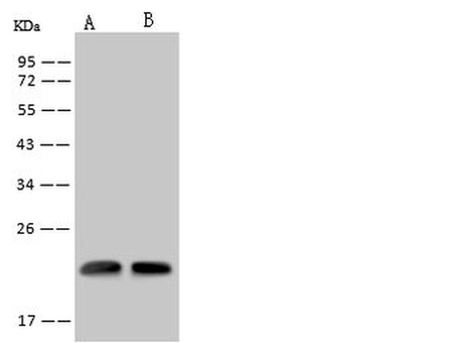 RWDD4 Antibody in Western Blot (WB)