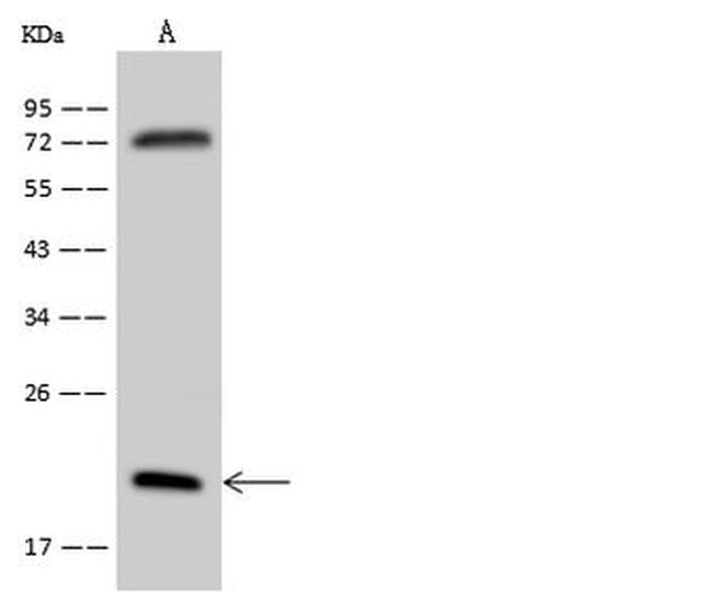 RPL18A Antibody in Western Blot (WB)