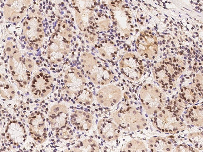 RFC3 Antibody in Immunohistochemistry (Paraffin) (IHC (P))