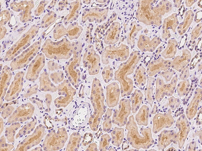 GLRB Antibody in Immunohistochemistry (Paraffin) (IHC (P))