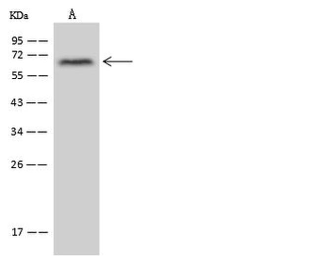 ZNF250 Antibody in Western Blot (WB)