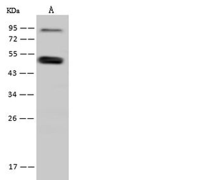 SNIP1 Antibody in Western Blot (WB)