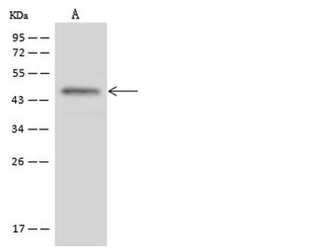 ST3GAL2 Antibody in Western Blot (WB)