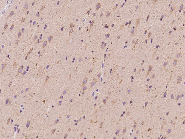 SYT11 Antibody in Immunohistochemistry (Paraffin) (IHC (P))