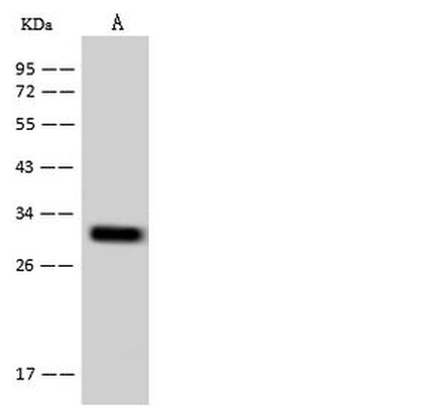 TM2D2 Antibody in Western Blot (WB)
